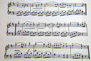 aluminium-print-music-notes